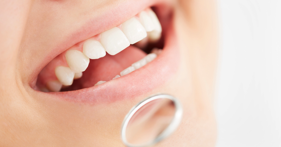 Clínica Dental Covallina. Sonrisa sin síntomas de periodontitis