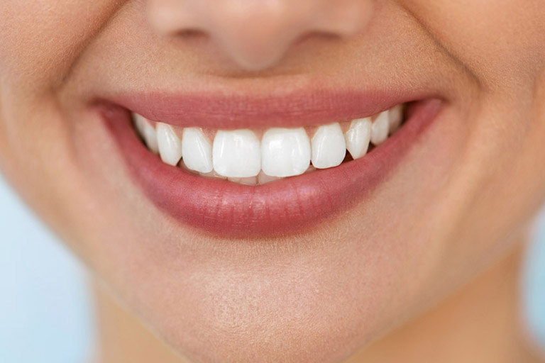 pueblo préstamo mucho → ¿Por qué tengo los dientes amarillos? | Clínica Dental en Mieres